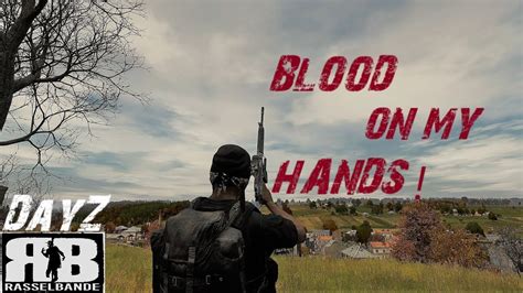 Dayz eating with bloody hands - Oct 2, 2019 · At lakes and other water bodies you kneel close to the water and look down at it and you should get the option, again your hands need to be empty. To clean with water bottle etc just hold it in your hands, one option is to drink, the other is to clean hands. #1. wolf urine Oct 2, 2019 @ 2:35am. Thanks a lot Derleth for your comprehensive advice ... 